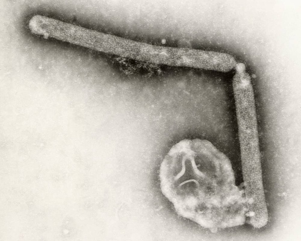 Avustralya Anakarasında İlk H5N1 Kuş Gribi Vakası Tespit Edildi
