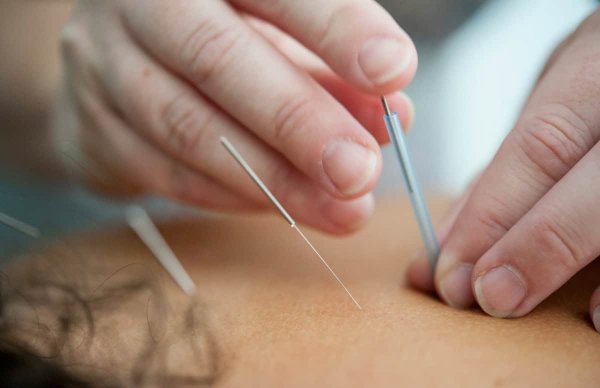 DEHB'li Çocuklarda Akupunktur Umut Vadediyor Ancak Bilim Daha Fazlasını İstiyor