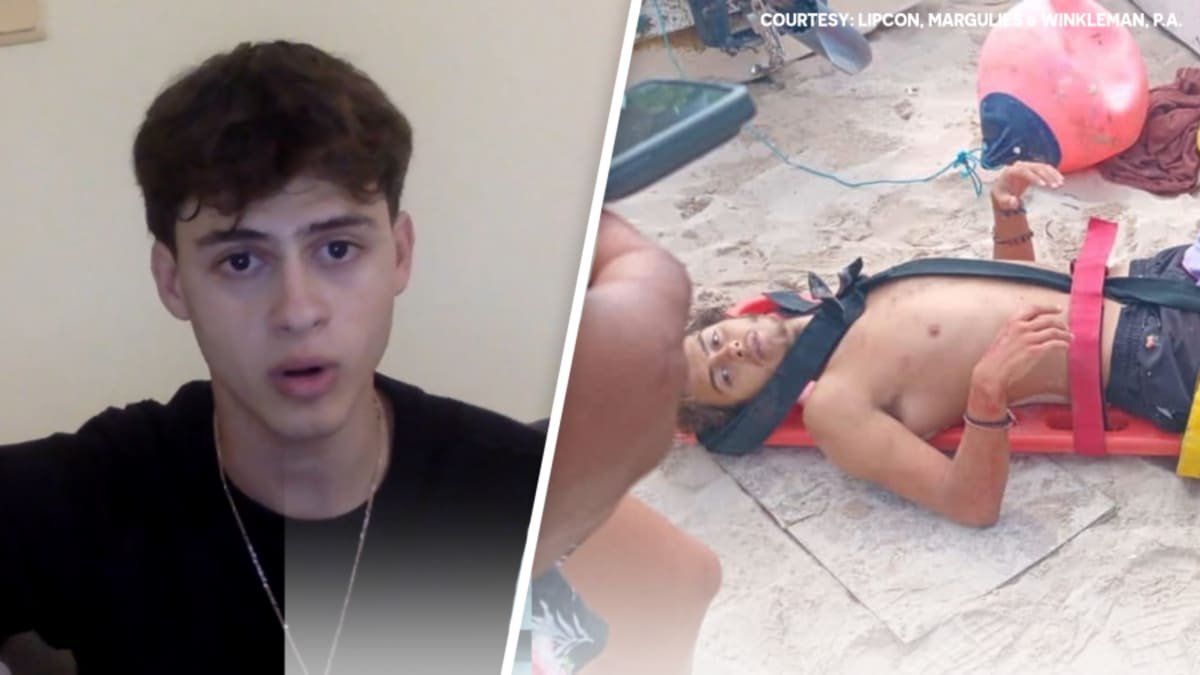 “Ölüyordum sandım”: Survivor Greece yıldızı bacağını kaybetmesinin ardından konuştu
