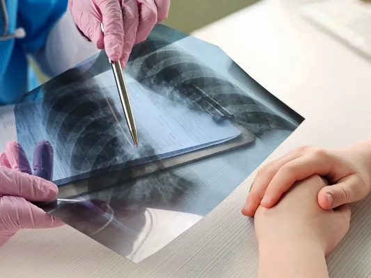 Yunanistan'da 500 Bini Aşkın Kişi Kistik Fibrozis Geni Taşıyor